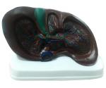 MODEL FICAT, PANCREAS, DUODEN
